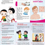 BỆNH THỦY ĐẬU