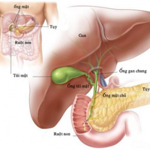 PHẪU THUẬT NỘI SOI CẮT TÚI MẬT