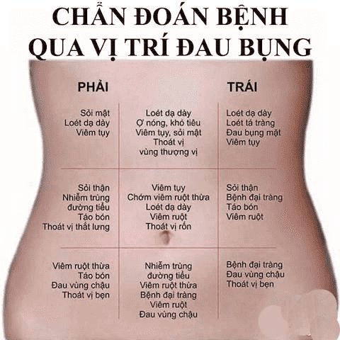 3. Triệu chứng nhận biết chớm viêm ruột thừa