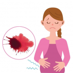 CHĂM SÓC SẢN  PHỤ DỌA SẢY