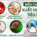 BỆNH XUẤT HUYẾT TIÊU HÓA