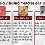 BỆNH VIÊM PHỔI