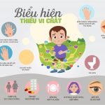 HƯỞNG ỨNG NGÀY VI CHẤT DINH DƯỠNG