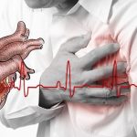 CƠN ĐAU THẮT NGỰC