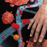 CÔNG VĂN 5470/BYT-DP TĂNG CƯỜNG PHÒNG CHỐNG BỆNH ĐẬU MÙA KHỈ