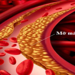 MỠ MÁU LÀ GÌ? Ý NGHĨA CỦA XÉT NGHIỆM MỠ MÁU