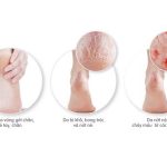 4 CHẤT BỔ SUNG TỐT NHẤT CHO DA KHÔ