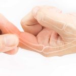 ĐỀ PHÒNG VIÊM THOÁI HOÁ KHỚP NGÓN TAY