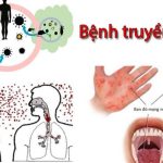 BỘ Y TẾ BAN HÀNH KẾ HOẠCH PHÒNG, CHỐNG BỆNH TRUYỀN NHIỄM NĂM 2023