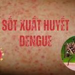 SỐT MẤY NGÀY THÌ XÉT NGHIỆM SỐT XUẤT HUYẾT? CÓ NHỮNG LOẠI XÉT NGHIỆM NÀO?
