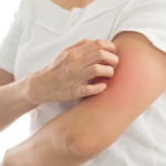 9 TRIỆU CHỨNG MÃN KINH DỄ BỊ PHỤ NỮ BỎ QUA