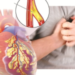 5 BIỆN PHÁP TỰ NHIÊN GIÚP GIẢM NGUY CƠ MẮC BỆNH TIM