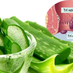 5 BÀI TẬP CẦN TRÁNH KHI BỊ BỆNH TRĨ