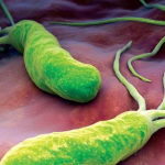 NHẬN BIẾT DẤU HIỆU, NGUYÊN NHÂN VIÊM LOÉT DẠ DÀY Ở TRẺ