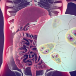 KHI NÀO CẦN XÉT NGHIỆM KÝ SINH TRÙNG Ở NGƯỜI?