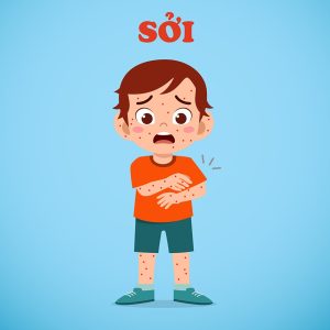 TĂNG CƯỜNG CÔNG TÁC PHÒNG, CHỐNG BỆNH SỞI