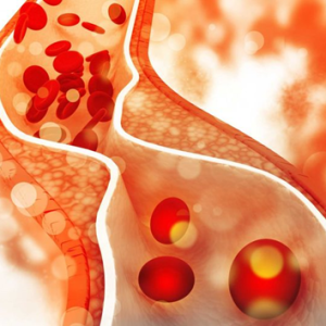 CẢI THIỆN CHOLESTEROL MÁU CẦN CHÚ Ý 5 ĐIỀU SAU