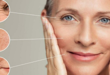 10 DẤU HIỆU CẢNH BÁO THIẾU COLLAGEN TRONG DA